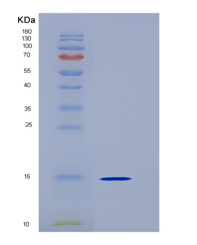 SDS-PAGE analysis of Human CST6 (Cystatin-M) - Recombinant Protein, showing >95% purity under 15% SDS-PAGE (Reduced)
