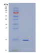 SDS-PAGE analysis of Human CST6 (Cystatin-M) - Recombinant Protein, showing >95% purity under 15% SDS-PAGE (Reduced)