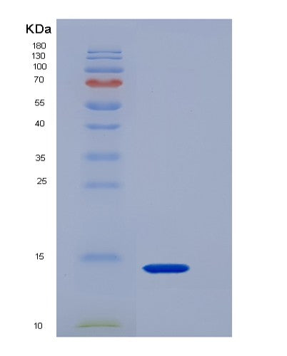 SDS-PAGE analysis of Mouse Agrp (Agouti-Related Protein) - Recombinant Protein, showing >85% purity under 15% SDS-PAGE (Reduced)