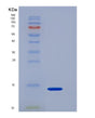 SDS-PAGE analysis of Mouse Agrp (Agouti-Related Protein) - Recombinant Protein, showing >85% purity under 15% SDS-PAGE (Reduced)