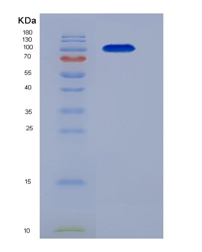 SDS-PAGE analysis of Human ERAP2 (Endoplasmic Reticulum Aminopeptidase 2) - Recombinant Protein, showing >95% purity under 15% SDS-PAGE (Reduced)