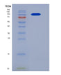 SDS-PAGE analysis of Human ERAP2 (Endoplasmic Reticulum Aminopeptidase 2) - Recombinant Protein, showing >95% purity under 15% SDS-PAGE (Reduced)