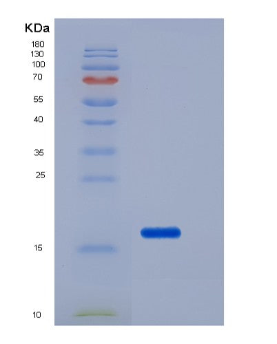 SDS-PAGE analysis of Human FZD10 (Frizzled-10) - Recombinant Protein, showing >85% purity under 15% SDS-PAGE (Reduced)