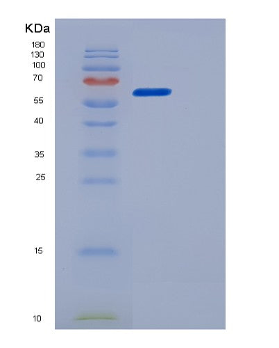 SDS-PAGE analysis of Human MGAT5 (Alpha-1,6-Mannosylglycoprotein 6-Beta-N-Acetylglucosaminyltransferase A) - Recombinant Protein, showing >85% purity under 15% SDS-PAGE (Reduced)