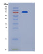 SDS-PAGE analysis of Mouse Kdr (Vascular Endothelial Growth Factor Receptor 2) - Recombinant Protein, showing >85% purity under 15% SDS-PAGE (Reduced)