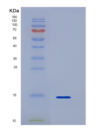 SDS-PAGE analysis of Human S100A9 (Protein S100-A9) - Recombinant Protein, showing >90% purity under 15% SDS-PAGE (Reduced)