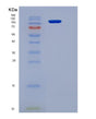 SDS-PAGE analysis of Mouse Kdr (Vascular Endothelial Growth Factor Receptor 2) - Recombinant Protein, showing >85% purity under 15% SDS-PAGE (Reduced)