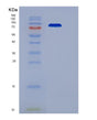 SDS-PAGE analysis of Human TEK (Angiopoietin-1 Receptor) - Recombinant Protein, showing >90% purity under 15% SDS-PAGE (Reduced)