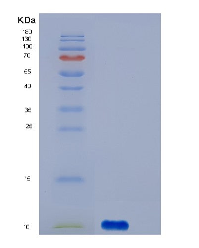 SDS-PAGE analysis of Human S100A12 (Protein S100-A12) - Recombinant Protein, showing >85% purity under 15% SDS-PAGE (Reduced)