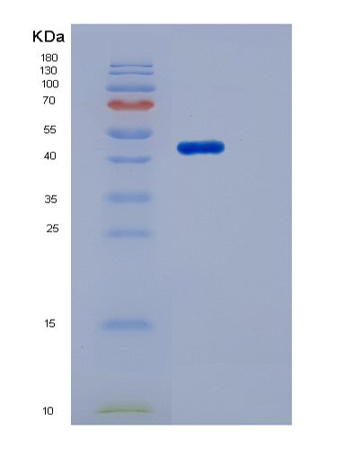 SDS-PAGE analysis of Human MSR1 (Macrophage Scavenger Receptor Types I And Ii) - Recombinant Protein, showing >95% purity under 15% SDS-PAGE (Reduced)