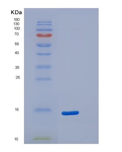 SDS-PAGE analysis of Human S100A5 (Protein S100-A5) - Recombinant Protein, showing >90% purity under 15% SDS-PAGE (Reduced)