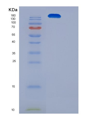 SDS-PAGE analysis of Human ITGAX (Integrin Alpha-X) - Recombinant Protein, CAT# BLT-08433P showing >90% purity under 15% SDS-PAGE (Reduced)