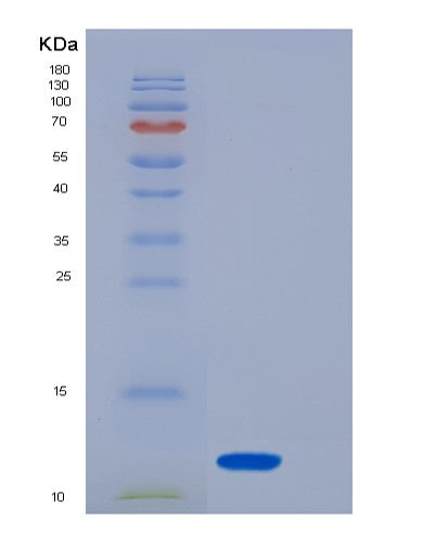 SDS-PAGE analysis of Human S100A8 (Protein S100-A8) - Recombinant Protein, showing >90% purity under 15% SDS-PAGE (Reduced)