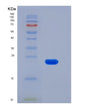 SDS-PAGE analysis of Human ULBP2 (Ul16-Binding Protein 2) - Recombinant Protein, showing >95% purity under 15% SDS-PAGE (Reduced)