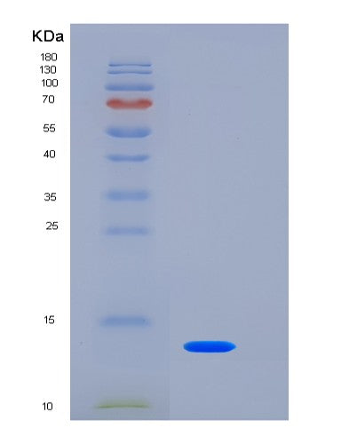 SDS-PAGE analysis of Human TSPAN8 (Tetraspanin-8) - Recombinant Protein, showing >95% purity under 15% SDS-PAGE (Reduced)