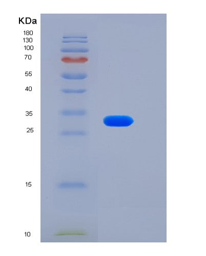 SDS-PAGE analysis of Human LSAMP (Limbic System-Associated Membrane Protein) - Recombinant Protein, showing >90% purity under 15% SDS-PAGE (Reduced)