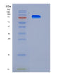 SDS-PAGE analysis of Mouse Tlr3 (Toll-Like Receptor 3) - Recombinant Protein, showing >95% purity under 15% SDS-PAGE (Reduced)