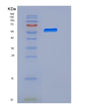SDS-PAGE analysis of Human BTD (Biotinidase) - Recombinant Protein, showing >95% purity under 15% SDS-PAGE (Reduced)