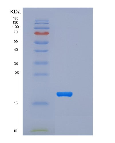 SDS-PAGE analysis of Mouse Trem2 (Triggering Receptor Expressed On Myeloid Cells 2) - Recombinant Protein, showing >95% purity under 15% SDS-PAGE (Reduced)