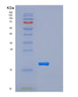 SDS-PAGE analysis of Mouse Trem2 (Triggering Receptor Expressed On Myeloid Cells 2) - Recombinant Protein, showing >95% purity under 15% SDS-PAGE (Reduced)