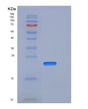 SDS-PAGE analysis of Mouse Clec7a (C-Type Lectin Domain Family 7 Member A) - Recombinant Protein, showing >95% purity under 15% SDS-PAGE (Reduced)