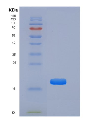 SDS-PAGE analysis of Mouse Tnfrsf19 (Tumor Necrosis Factor Receptor Superfamily Member 19) - Recombinant Protein, showing >85% purity under 15% SDS-PAGE (Reduced)
