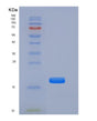 SDS-PAGE analysis of Mouse Tnfrsf19 (Tumor Necrosis Factor Receptor Superfamily Member 19) - Recombinant Protein, showing >85% purity under 15% SDS-PAGE (Reduced)