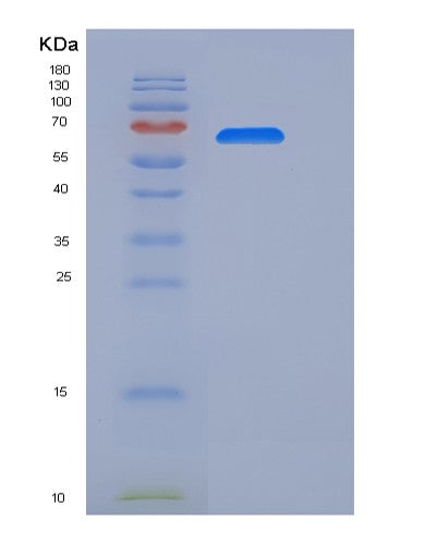 SDS-PAGE analysis of Mouse Il6st (Interleukin-6 Receptor Subunit Beta) - Recombinant Protein, showing >85% purity under 15% SDS-PAGE (Reduced)