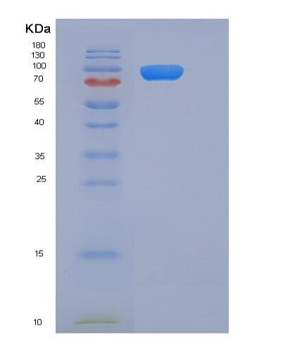 SDS-PAGE analysis of Mouse Il6st (Interleukin-6 Receptor Subunit Beta) - Recombinant Protein, showing >85% purity under 15% SDS-PAGE (Reduced)