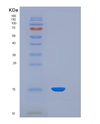 SDS-PAGE analysis of Human TTR (Transthyretin) - Recombinant Protein, showing >90% purity under 15% SDS-PAGE (Reduced)