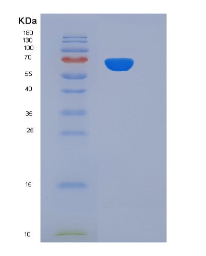 SDS-PAGE analysis of Human SMPD1 (Sphingomyelin Phosphodiesterase) - Recombinant Protein, showing >85% purity under 15% SDS-PAGE (Reduced)