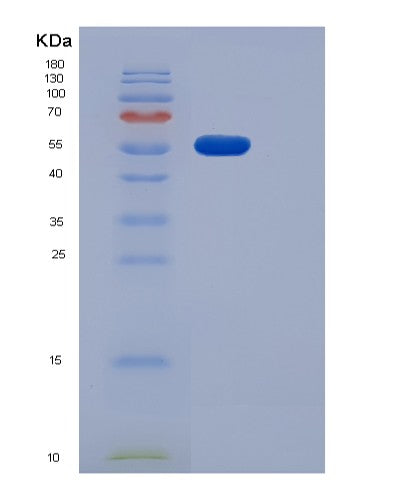 SDS-PAGE analysis of Human PDGFRA (Platelet-Derived Growth Factor Receptor Alpha) - Recombinant Protein, showing >85% purity under 15% SDS-PAGE (Reduced)
