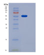 SDS-PAGE analysis of Human PDGFRA (Platelet-Derived Growth Factor Receptor Alpha) - Recombinant Protein, showing >85% purity under 15% SDS-PAGE (Reduced)