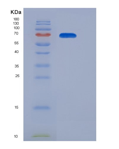 SDS-PAGE analysis of Mouse Il12rb2 (Interleukin-12 Receptor Subunit Beta-2) - Recombinant Protein, showing >95% purity under 15% SDS-PAGE (Reduced)