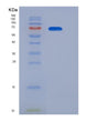 SDS-PAGE analysis of Mouse Il12rb2 (Interleukin-12 Receptor Subunit Beta-2) - Recombinant Protein, showing >95% purity under 15% SDS-PAGE (Reduced)
