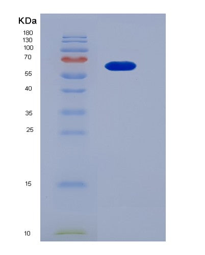 SDS-PAGE analysis of Human FGFR4 (Fibroblast Growth Factor Receptor 4) - Recombinant Protein, showing >95% purity under 15% SDS-PAGE (Reduced)