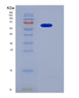 SDS-PAGE analysis of Human FGFR4 (Fibroblast Growth Factor Receptor 4) - Recombinant Protein, showing >95% purity under 15% SDS-PAGE (Reduced)