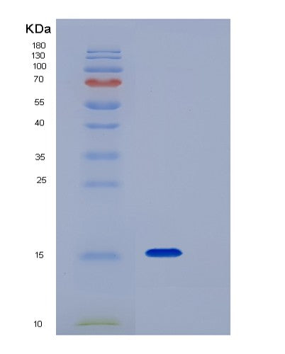 SDS-PAGE analysis of Human TNFRSF19 (Tumor Necrosis Factor Receptor Superfamily Member 19) - Recombinant Protein, showing >95% purity under 15% SDS-PAGE (Reduced)