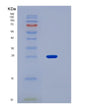SDS-PAGE analysis of Human NTRK1 (High Affinity Nerve Growth Factor Receptor) - Recombinant Protein, showing >95% purity under 15% SDS-PAGE (Reduced)