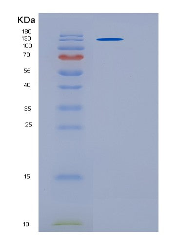 SDS-PAGE analysis of Human PAPPA2 (Pappalysin-2) - Recombinant Protein, showing >95% purity under 15% SDS-PAGE (Reduced)