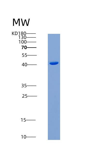 SDS-PAGE analysis of Human TNFRSF10B (Tumor Necrosis Factor Receptor Superfamily Member 10B) - Recombinant Protein, showing >90% purity under 15% SDS-PAGE (Reduced)
