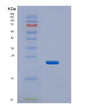 SDS-PAGE analysis of Mouse Lcn2 (Neutrophil Gelatinase-Associated Lipocalin) - Recombinant Protein, showing >90% purity under 15% SDS-PAGE (Reduced)