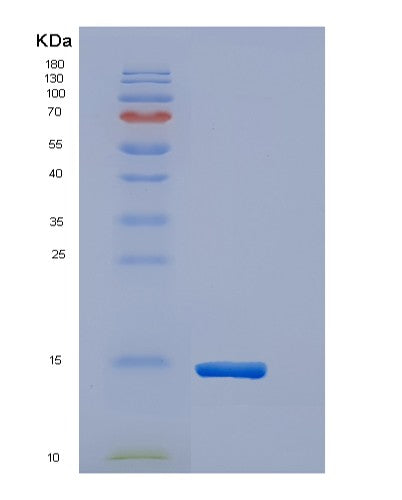 SDS-PAGE analysis of Human TNFRSF13B (Tumor Necrosis Factor Receptor Superfamily Member 13B) - Recombinant Protein, showing >90% purity under 15% SDS-PAGE (Reduced)