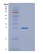 SDS-PAGE analysis of Mouse Apcs (Serum Amyloid P-Component) - Recombinant Protein, showing >90% purity under 15% SDS-PAGE (Reduced)