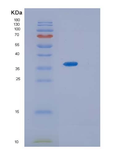 SDS-PAGE analysis of Mouse Il13ra2 (Interleukin-13 Receptor Subunit Alpha-2) - Recombinant Protein, showing >85% purity under 15% SDS-PAGE (Reduced)