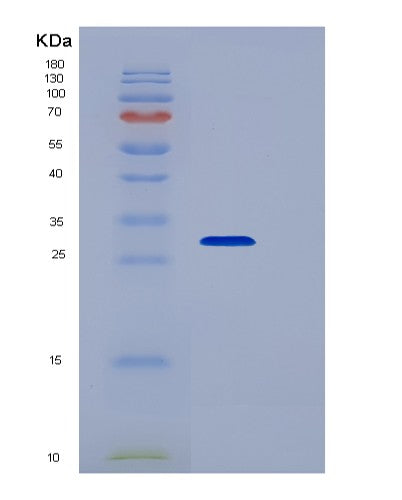 SDS-PAGE analysis of Human RNASET2 (Ribonuclease T2) - Recombinant Protein, showing >90% purity under 15% SDS-PAGE (Reduced)