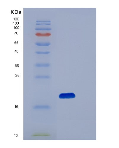 SDS-PAGE analysis of Human PIN1 (Peptidyl-Prolyl Cis-Trans Isomerase Nima-Interacting 1) - Recombinant Protein, showing >90% purity under 15% SDS-PAGE (Reduced)
