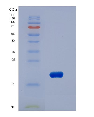 SDS-PAGE analysis of Human PIN1 (Peptidyl-Prolyl Cis-Trans Isomerase Nima-Interacting 1) - Recombinant Protein, showing >90% purity under 15% SDS-PAGE (Reduced)
