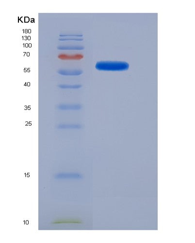 SDS-PAGE analysis of Mouse Plaur (Urokinase Plasminogen Activator Surface Receptor) - Recombinant Protein, showing >85% purity under 15% SDS-PAGE (Reduced)