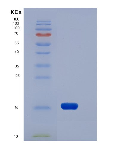 SDS-PAGE analysis of Human EDA2R (Tumor Necrosis Factor Receptor Superfamily Member 27) - Recombinant Protein, showing >95% purity under 15% SDS-PAGE (Reduced)